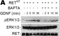 Detection of Mouse Ret by Western Blot