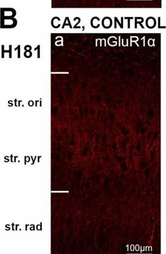 Detection of mGluR1 by Immunohistochemistry