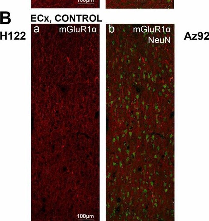 Detection of mGluR1 by Immunohistochemistry