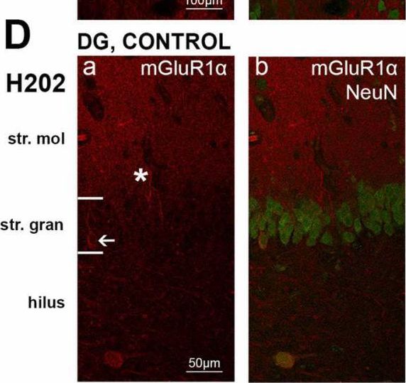 Detection of mGluR1 by Immunohistochemistry