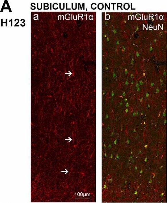 Detection of mGluR1 by Immunohistochemistry