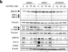 Detection of GRP78/HSPA5 by Western Blot