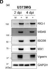 Detection of RIG-I by Western Blot