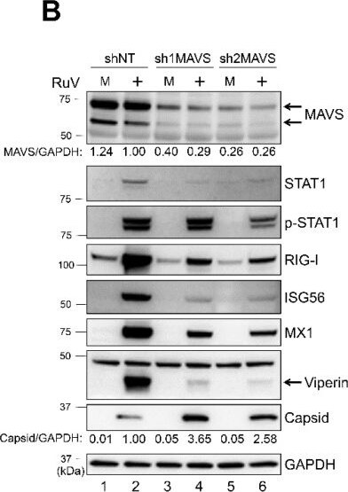 Detection of RIG-I by Western Blot
