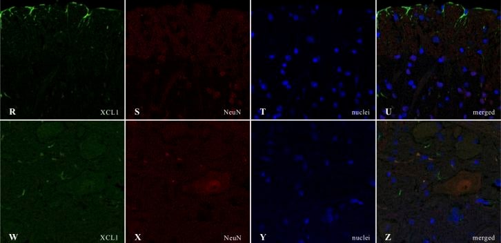 Detection of XCL1/Lymphotactin by Immunohistochemistry