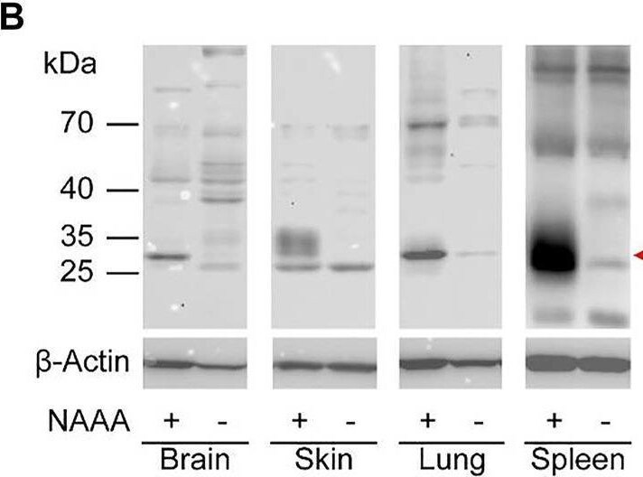 Detection of ASAHL/N-acylethanolamine-hydrolyzing Acid A by Western Blot