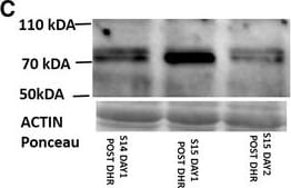 Detection of Human Kirrel3/NEPH2 by Western Blot