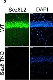 Detection of SEZ6L2/BSRP-A by Immunohistochemistry