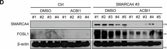Detection of FRA-1 by Western Blot