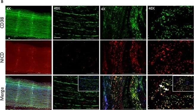 Detection of CD38 by Immunohistochemistry