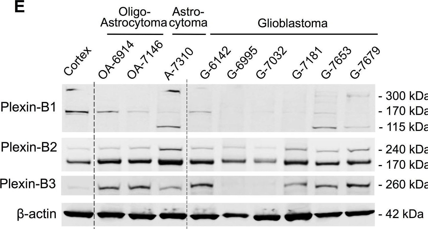 Detection of Plexin B3 by Western Blot