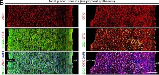 Detection of ZIC1 by Immunohistochemistry