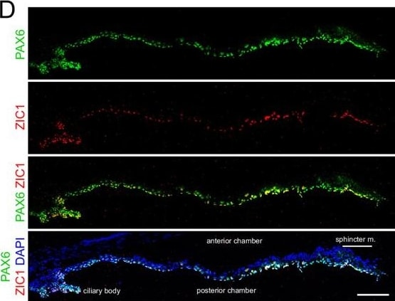 Detection of ZIC1 by Immunohistochemistry