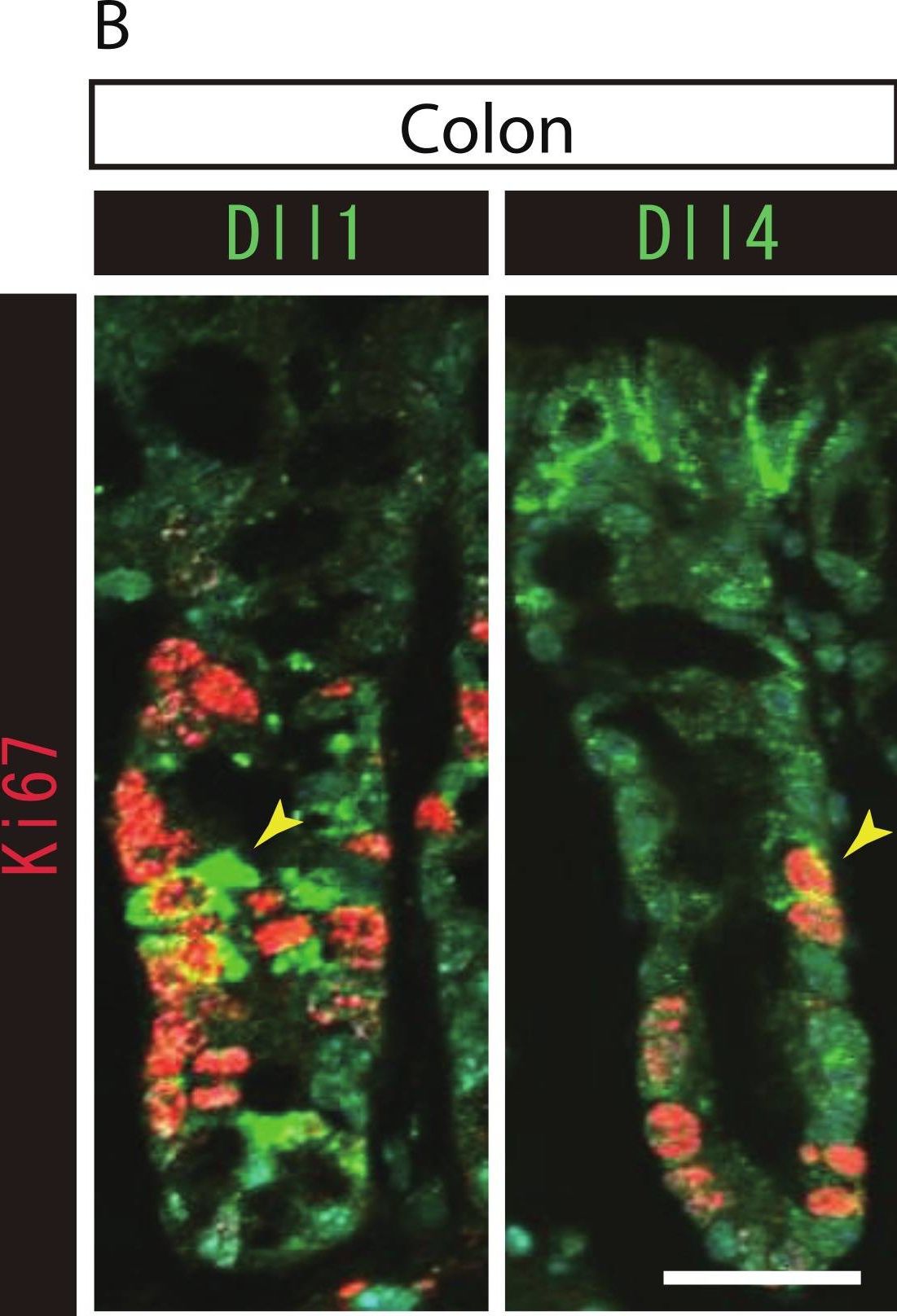 Detection of Mouse DLL1 by Immunohistochemistry