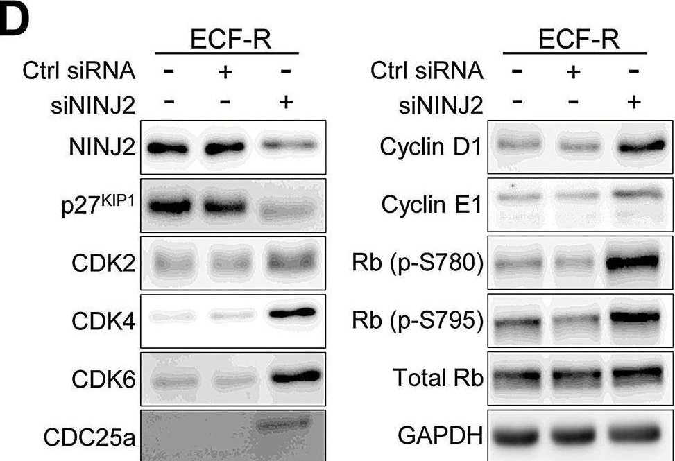 Detection of Ninjurin-2 by Western Blot