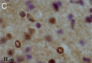 Detection of Rat IL-6 by Immunocytochemistry/ Immunofluorescence