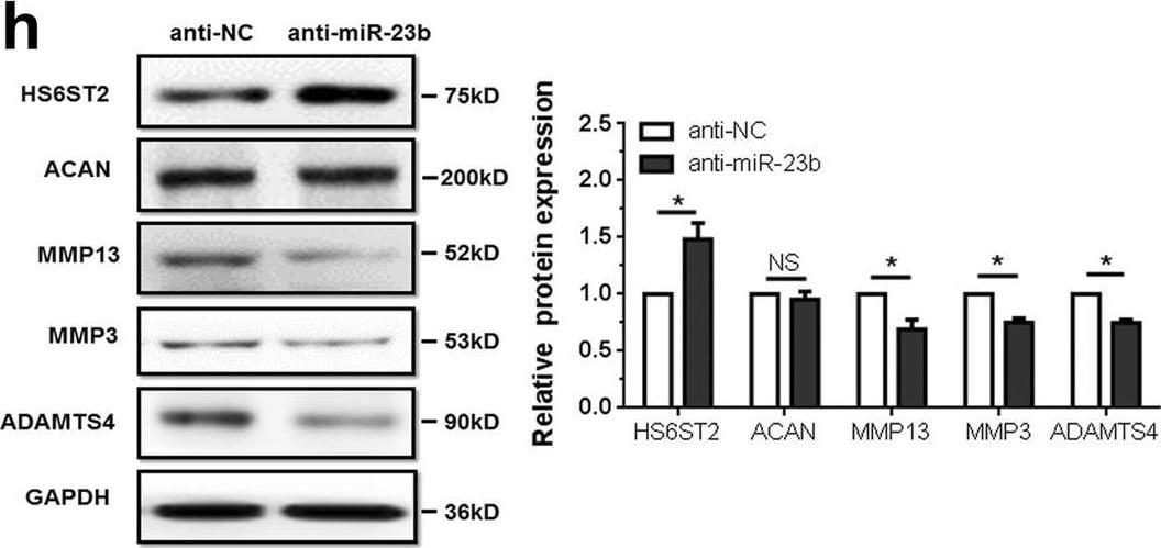 Detection of MMP-13 by Western Blot