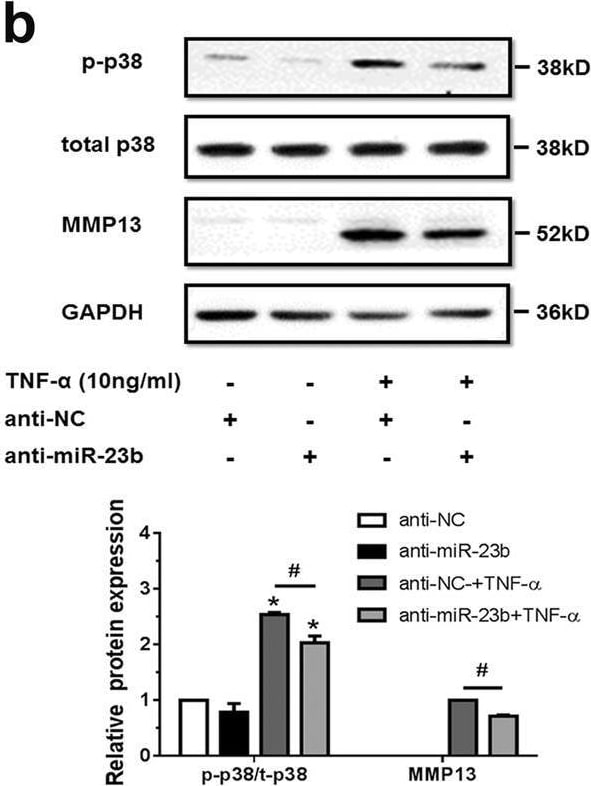 Detection of MMP-13 by Western Blot
