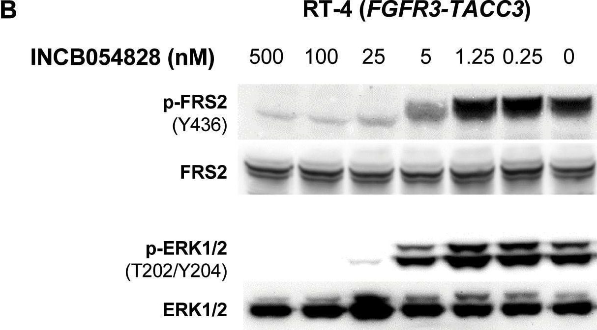 Detection of Phospho-FRS2 (Y436) by Western Blot