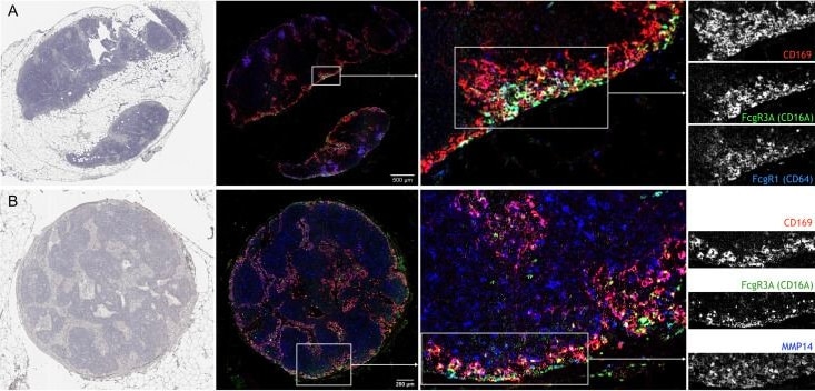 Detection of Siglec-1/CD169 by Immunohistochemistry