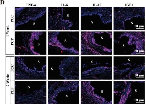 Detection of IL-10 by Immunohistochemistry