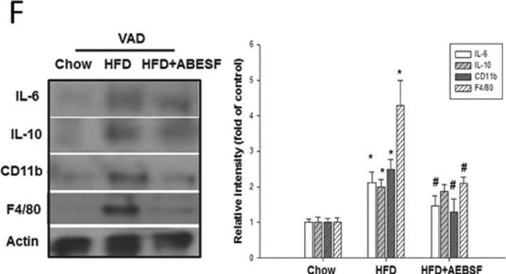 Detection of IL-10 by Western Blot