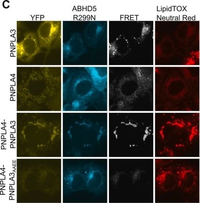 Detection of Adiponutrin/PNPLA3 by Immunocytochemistry/ Immunofluorescence