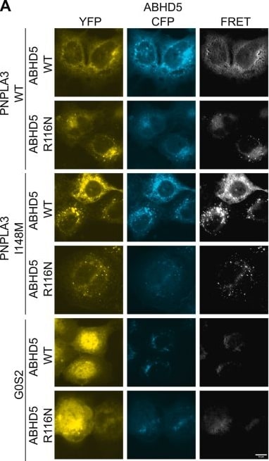 Detection of Adiponutrin/PNPLA3 by Immunocytochemistry/ Immunofluorescence