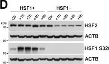 Detection of HSF2 by Western Blot