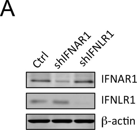 Detection of IL-28 R alpha /IFN-lambda R1 by Western Blot