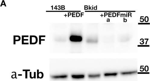 Detection of Human PEDFR/PNPLA2/ATGL by Western Blot