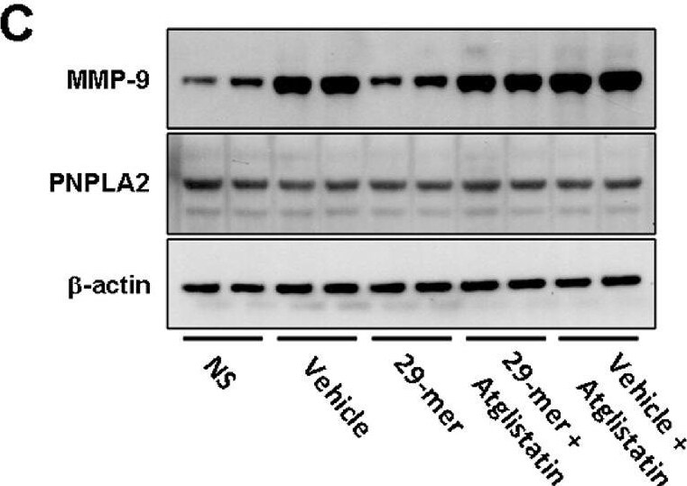 Detection of PEDFR/PNPLA2 by Western Blot