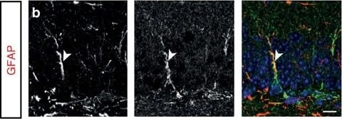 Detection of Mouse Plexin C1 by Immunocytochemistry/Immunofluorescence