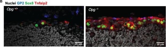 Detection of IL-3R beta by Immunohistochemistry