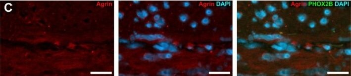 Detection of Agrin by Immunohistochemistry