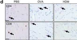 Detection of CD4 by Immunohistochemistry