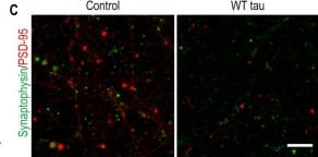 Detection of Synaptophysin by Immunohistochemistry
