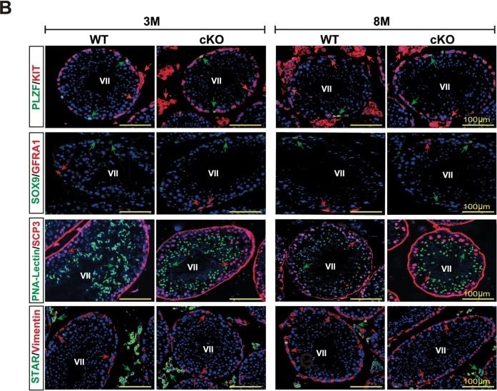 Detection of Mouse GFR alpha-1/GDNF R alpha-1 by Western Blot