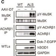 Detection of Mouse MuSK by Western Blot