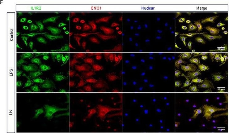 Detection of IL-1 RII by Immunocytochemistry/ Immunofluorescence