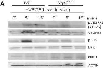 Detection of Neuropilin-1 by Western Blot