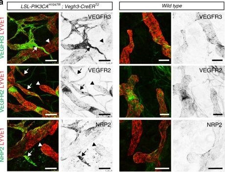 Detection of Neuropilin-2 by Immunohistochemistry