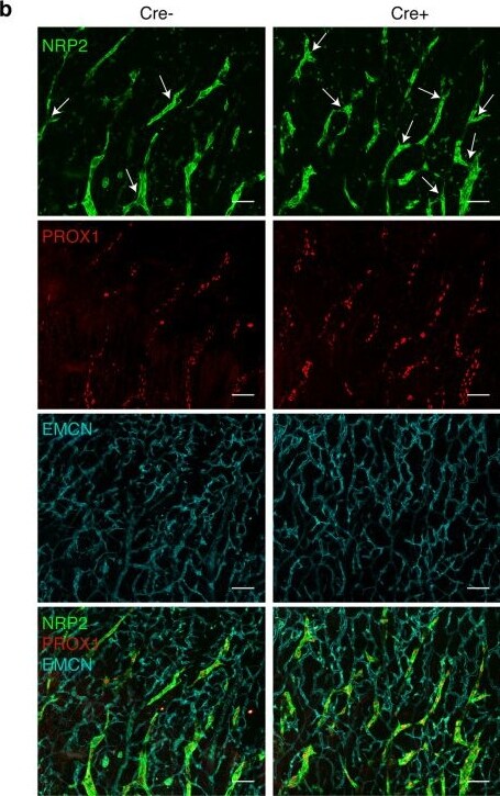 Detection of Neuropilin-2 by Immunohistochemistry