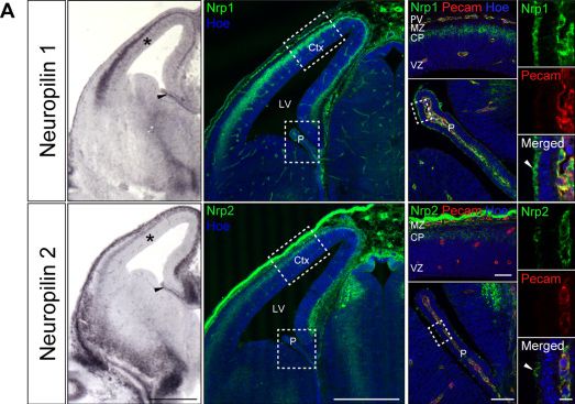 Detection of Neuropilin-2 by Immunohistochemistry