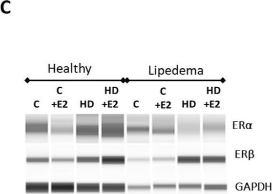 Detection of ER alpha/NR3A1 by Western Blot