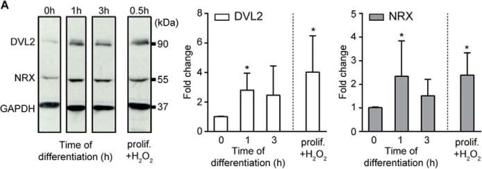 Detection of Human Nucleoredoxin by Western Blot