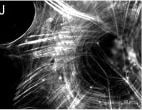 Detection of Human WT1 by Immunocytochemistry/Immunofluorescence