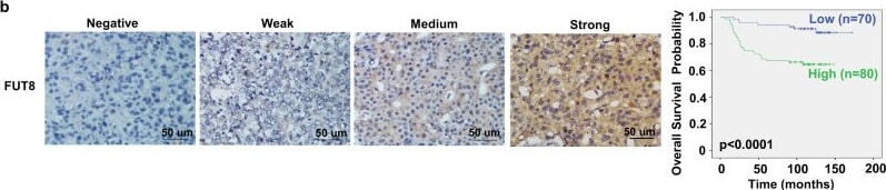 Detection of FUT8 by Immunohistochemistry