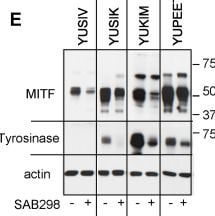 Detection of MITF by Western Blot