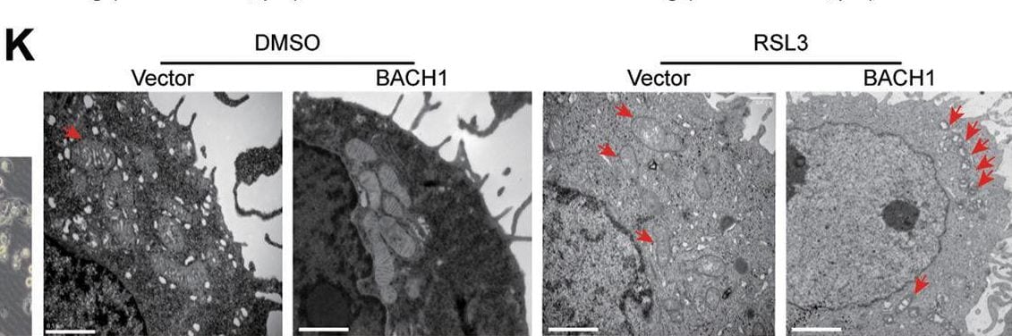 Detection of BACH1 by Immunohistochemistry